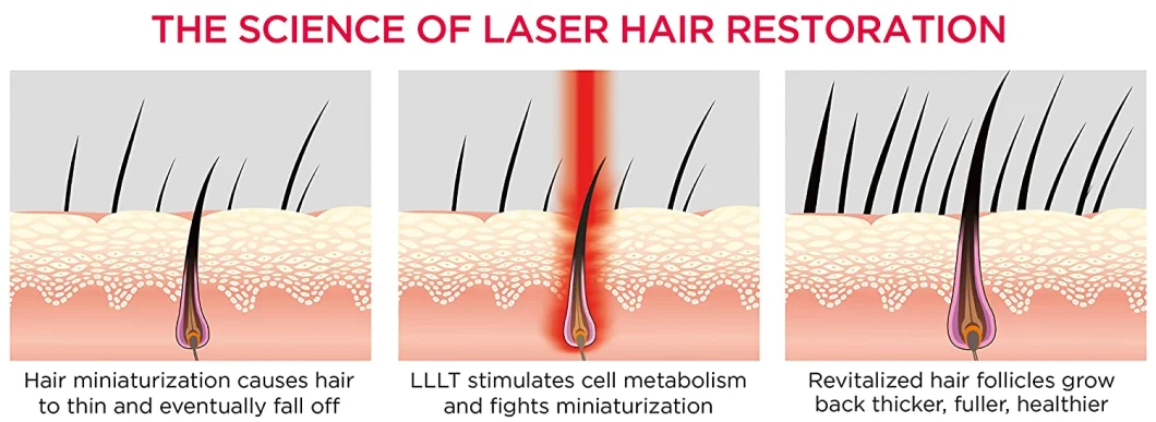 Laser Cap for Hair Growth